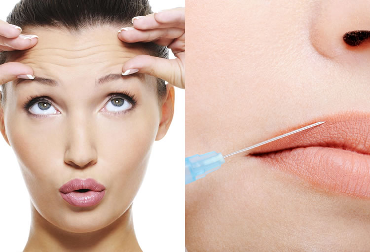 fillers and botox